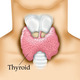 Illustration for article titled Starting Thyroid Hormone Replacement